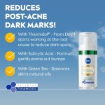 nivea-cellular-luminous630-anti-spots-post-acne-marks-serum-30ml